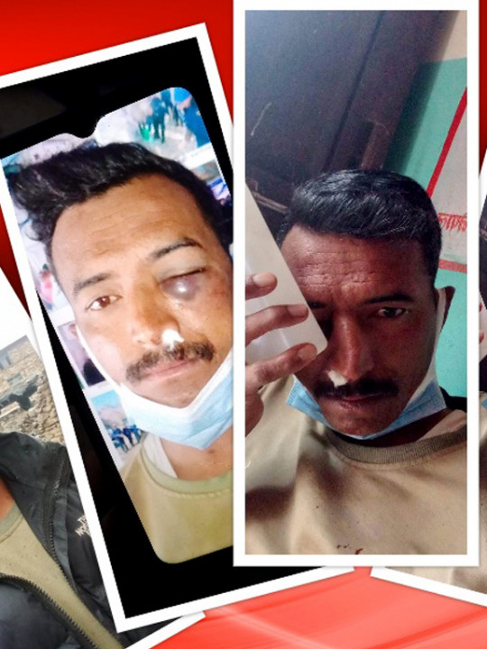 इन्स्पेक्टरले हवल्दारलाई मरणासन्न हुने गरी कुटपिट!!!!