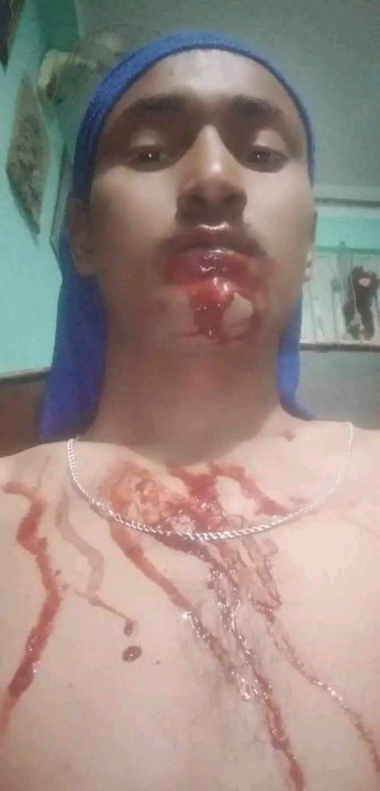 उपचारको लागि आर्थिक सहयोगको अपिल